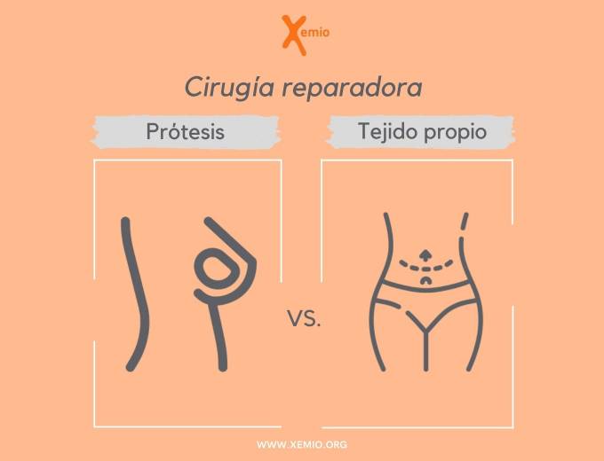 Prótesis mamaria vs. Tejido propio