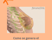 Videoteca: ¿Cómo se origina el cáncer de mama?